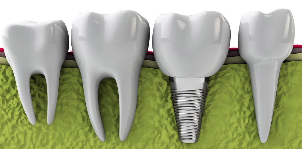 blog inner thumb : The Edge dental