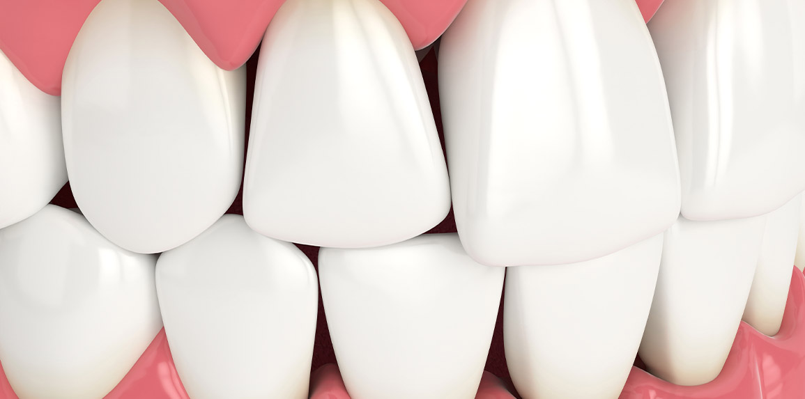 blog - The Edge dental