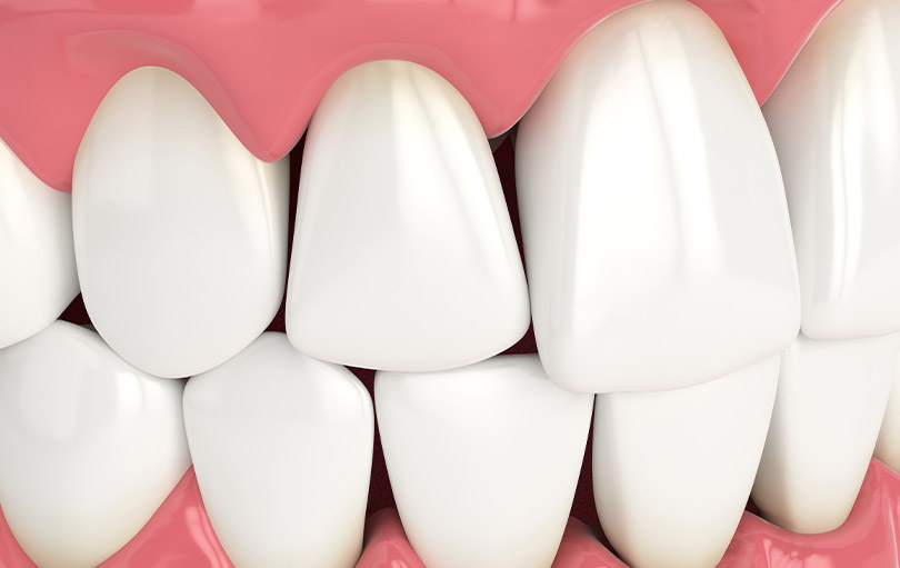 blog - The Edge dental