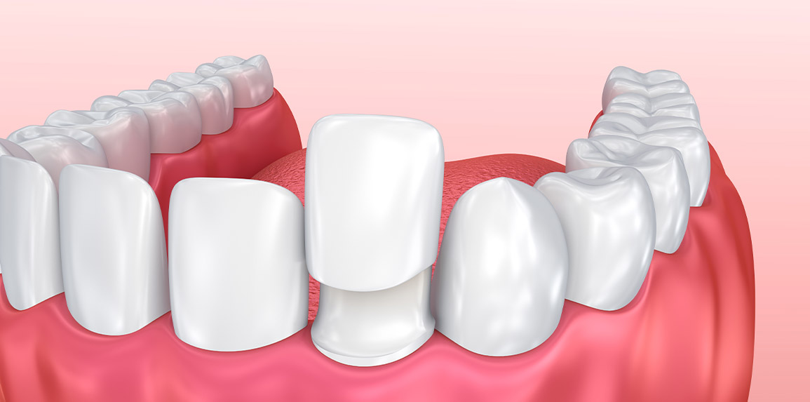 blog - The Edge dental