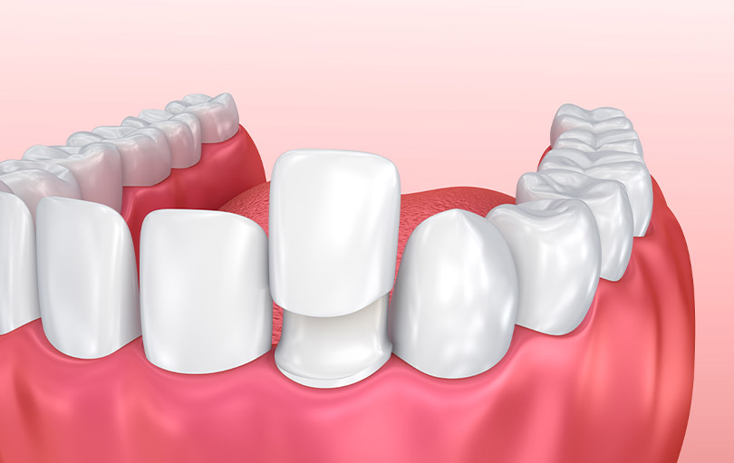 blog - The Edge dental