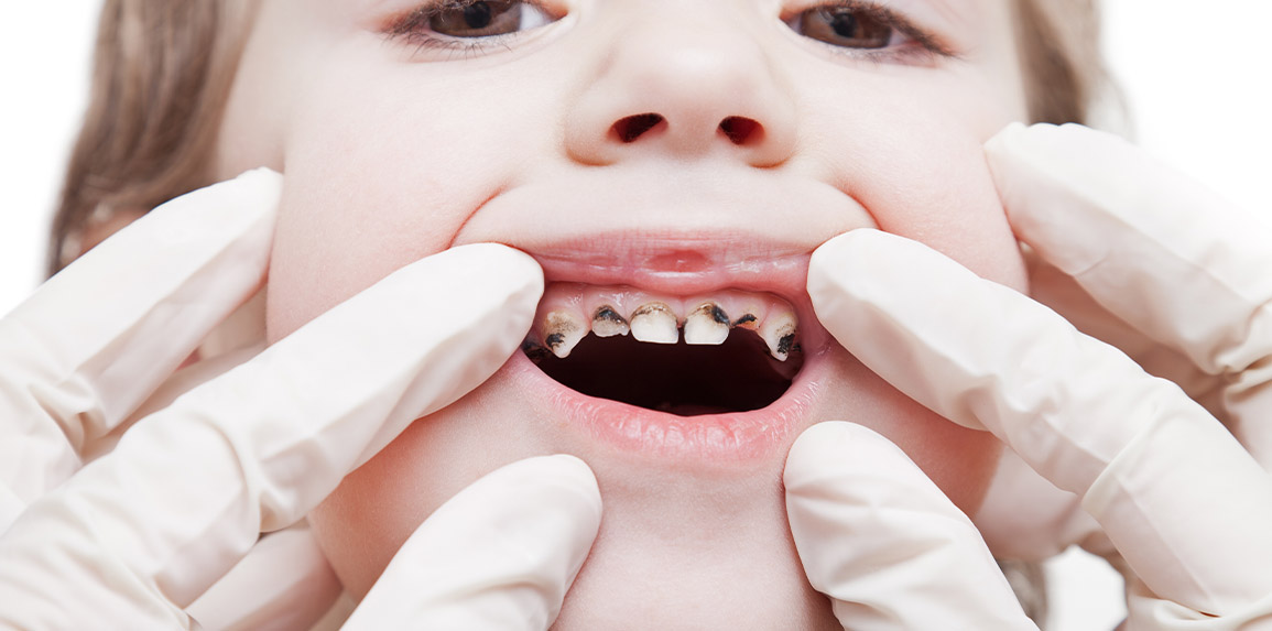 blog - The Edge dental