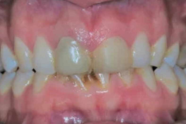 Before - The Edge dental