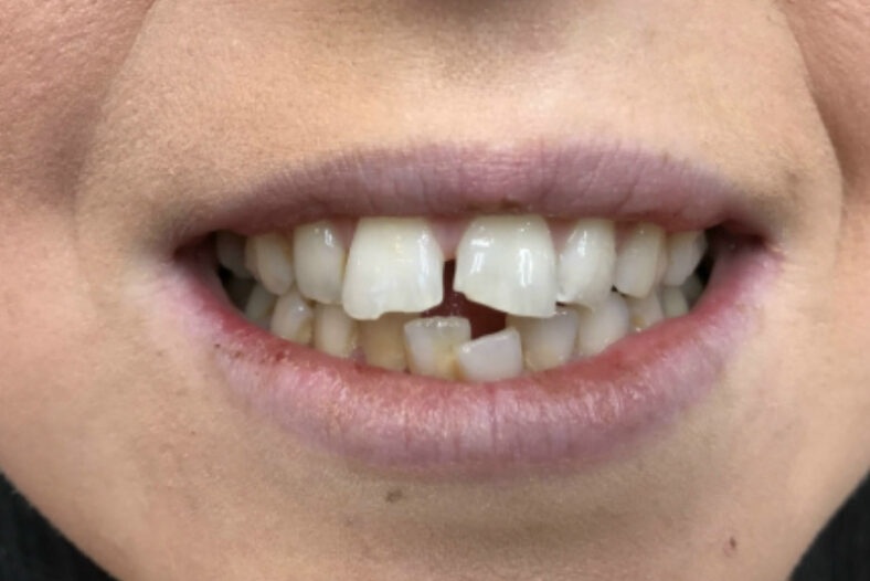 Before - The Edge Dental