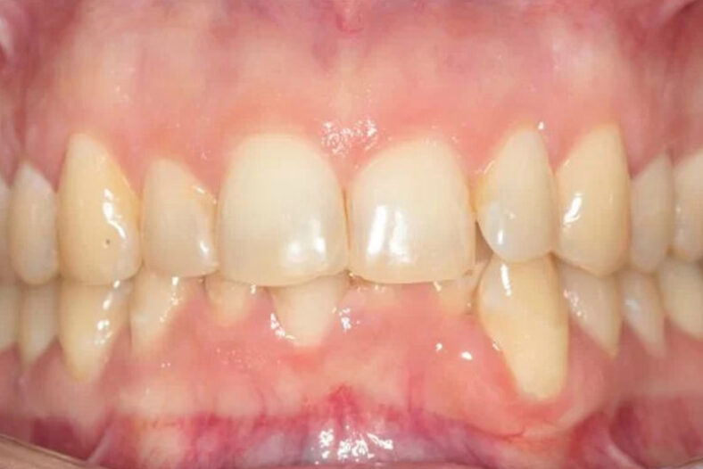 Before - The Edge dental