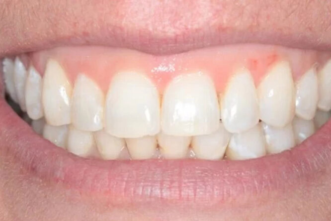 After - The Edge Dental