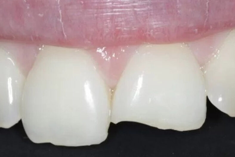 Before - The Edge dental