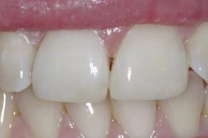 After - The Edge Dental