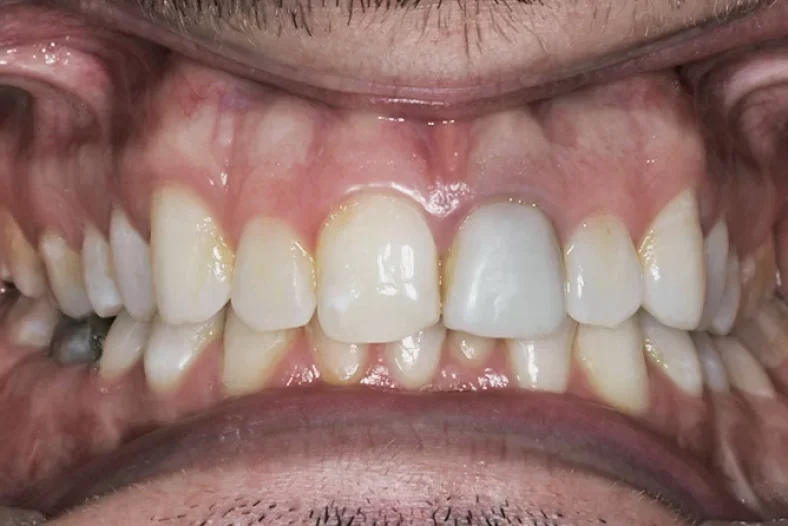 Before - The Edge dental