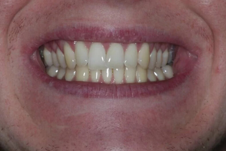 Before - The Edge Dental