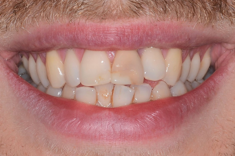 Before - The Edge Dental