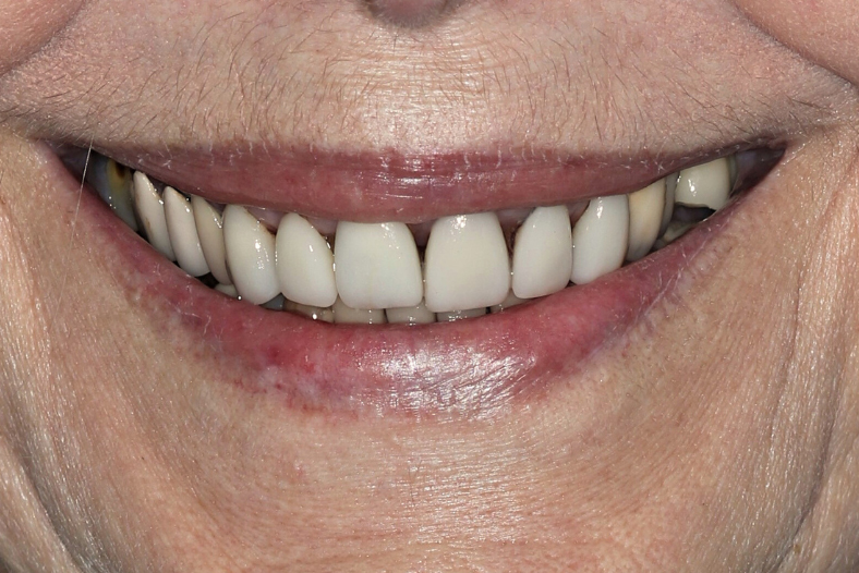 Before - The Edge dental