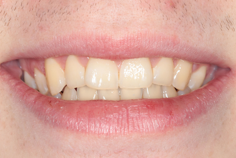 Before - The Edge Dental