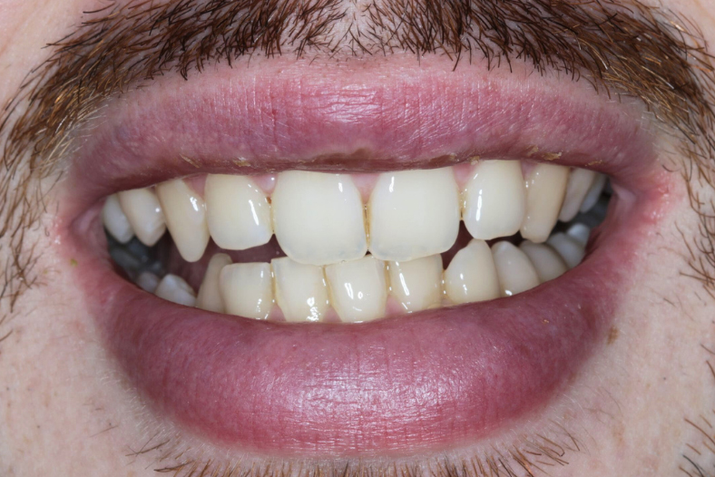 Before - The Edge dental