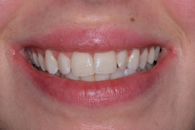 Before - The Edge dental