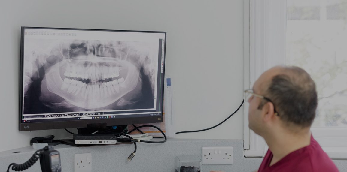 Home Slide DImplant- The Edge Dental blog - The Edge dental
