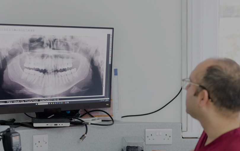 blog - The Edge dental